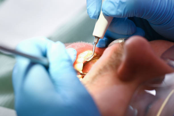 Best Emergency Dentist for Knocked-Out Tooth in Olympia Fields, IL