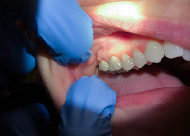 Best Emergency Cosmetic Dentistry in Olympia Fields, IL